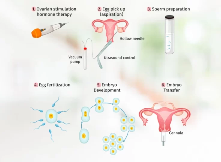 egg donation procedure