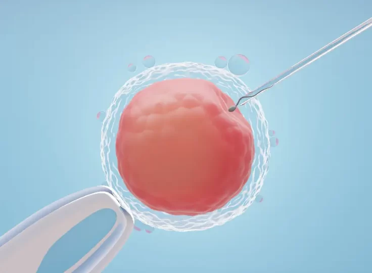 IVF with Donor Eggs