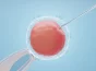 IVF with Donor Eggs